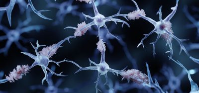 amyloid aggregates