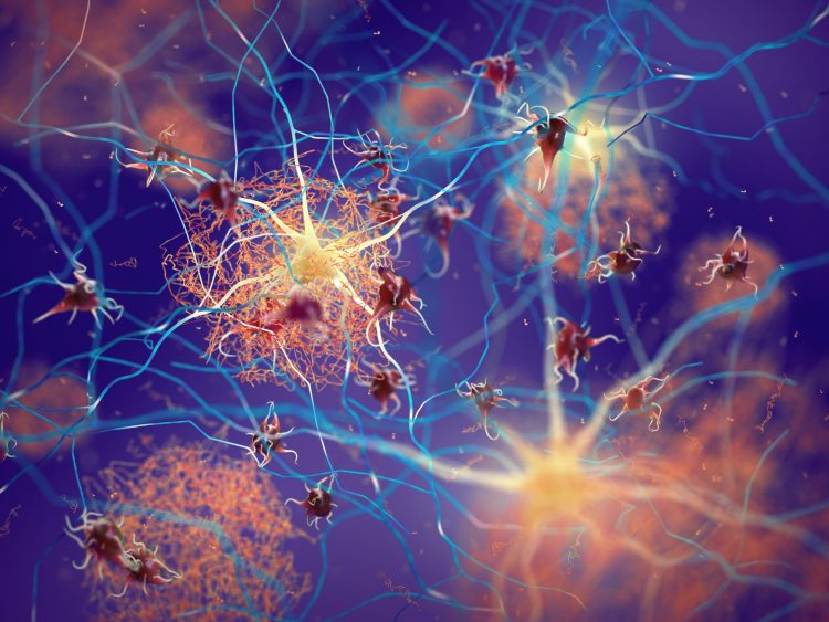 Three-dimensional (3D) illustration of amyloid beta plaques (brown mesh-like shapes) forming between neurons and disrupting their function. Amyloid plaques are a hallmark of Alzheimer’s Disease.