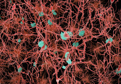 TLR5 amyloid plaques