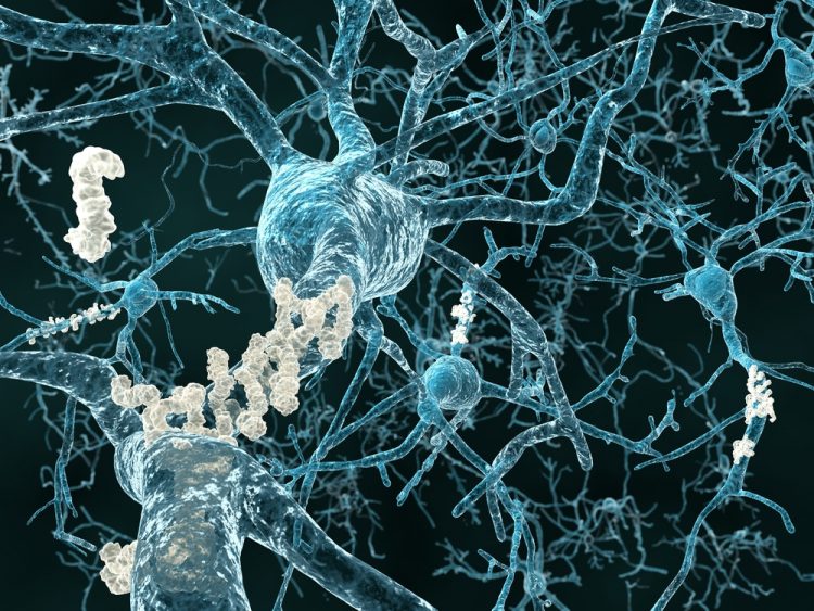 Amyloid plaque in brain