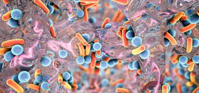 antibiotic resistance