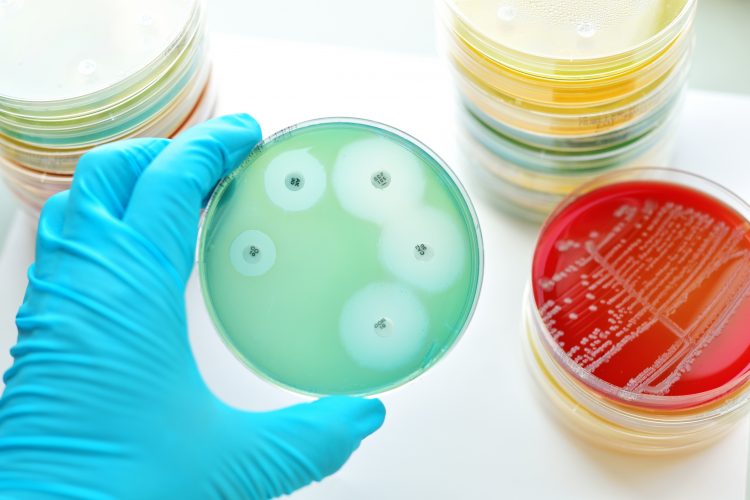 hand holding petri dish in which antibiotic sensitivity has been tested with bacteria, leaving rings surrounding paper disks containing compounds