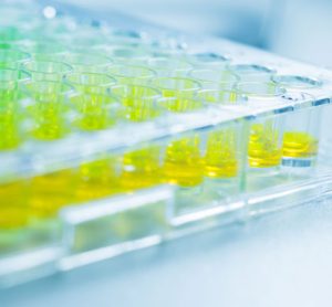 DiscoverX KINOMEscan® Kinase Assay Screening