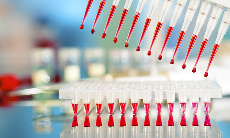 Tools for PCR amplification of DNA: 96-well plate and automatic pipette