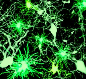 neurological