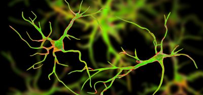 two astrocytes coloured green