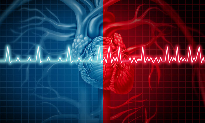 Collaborative team first to identify the perinexus in the human heart