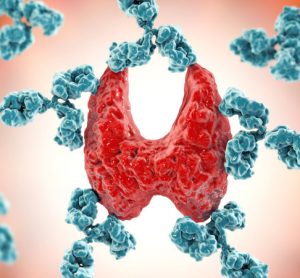 autoimmune response