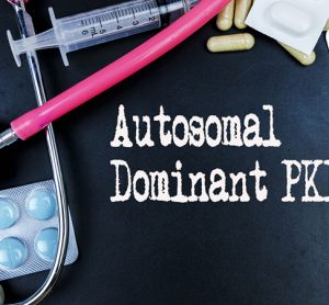 Autosomal Dominant PKD word, medical term word with medical concepts in blackboard and medical equipment background.