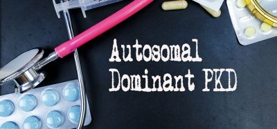 Autosomal Dominant PKD word, medical term word with medical concepts in blackboard and medical equipment background.