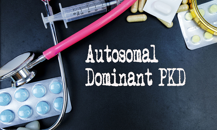 Autosomal Dominant PKD word, medical term word with medical concepts in blackboard and medical equipment background.