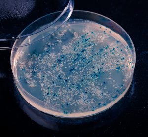 white or blue bacteria colonies speckling petri dish agar