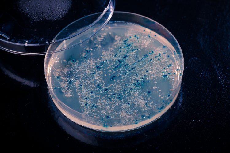 white or blue bacteria colonies speckling petri dish agar