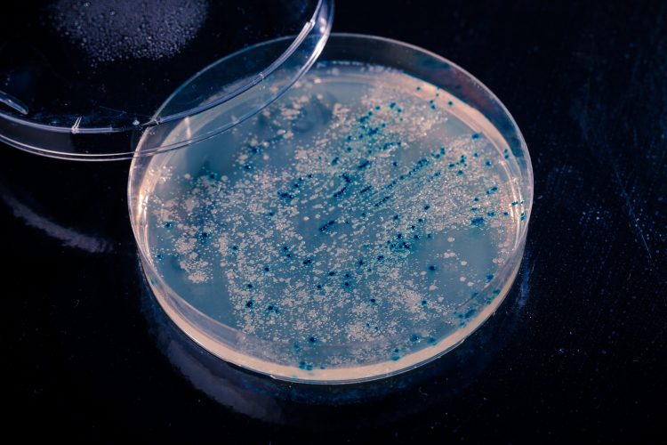 white or blue bacteria colonies speckling petri dish agar