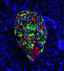 image of beta cells from the genetically mutated mouse pancreas