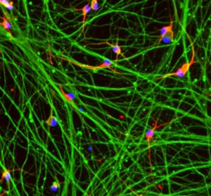 Improving Huntington’s disease drug discovery with new reproducible disease models