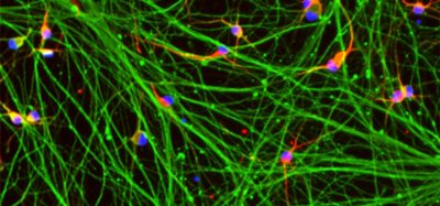 Improving Huntington’s disease drug discovery with new reproducible disease models