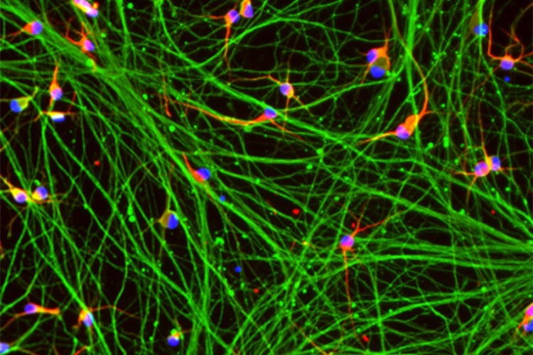 Improving Huntington’s disease drug discovery with new reproducible disease models