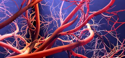 3D image of blood vessel
