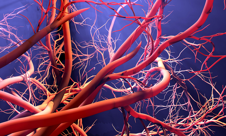 3D image of blood vessel