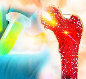 long bone (femur) in red with a gloved hand holding an eppendorf of yellow liquid behind - idea of bone marrow cancer therapy development