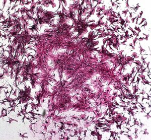 skeletal stem cells