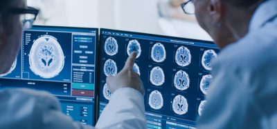 In Control Room Doctor and Radiologist Discuss Diagnosis while Watching Procedure and Monitors Showing Brain Scans Results, In the Background Patient Undergoes MRI or CT Scan Procedure.