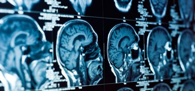 brain imaging