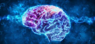 brain organoid