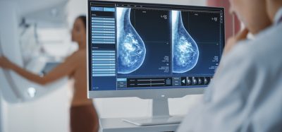 breast cancer