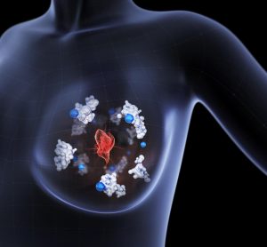 Illustration of how Atox1 expressing cells migrate from the primary tumour in the breast