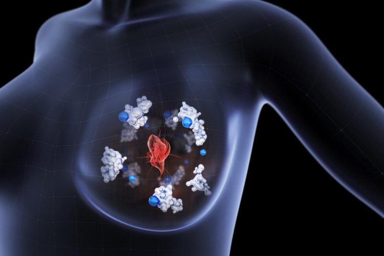 Protein found to control breast cancer metastasis