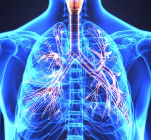 COPD
