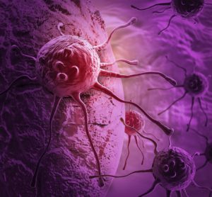 cancer-cells