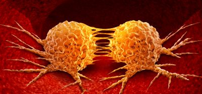 orange cancer cells dividing in red tissue