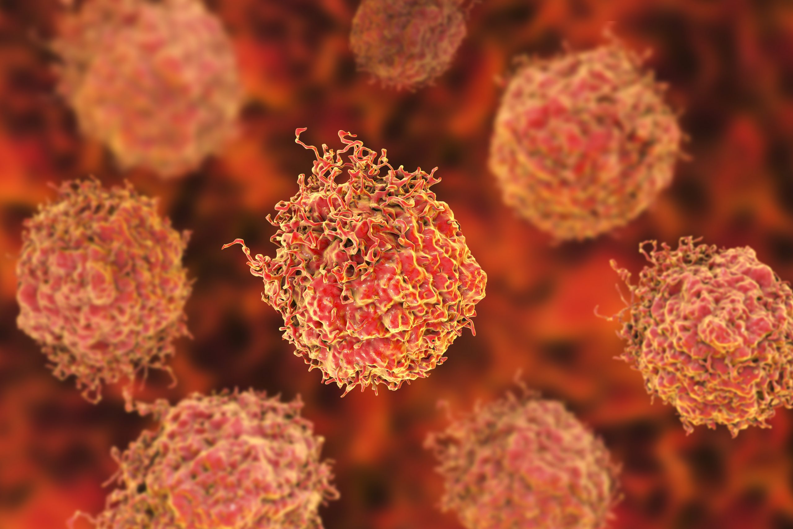 3D rendering of an artists impression of cancer cells