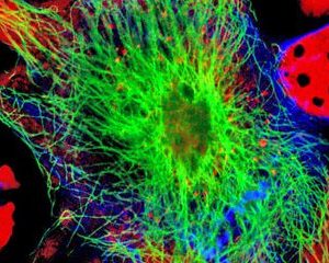 cancer stem cells