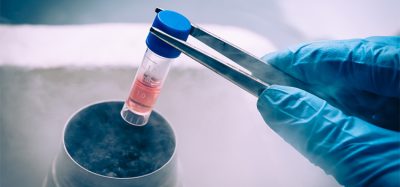 A Liquid Nitrogen bank containing suspension of stem cells. Cell culture for the biomedical diagnostic.