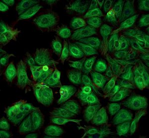 organelles
