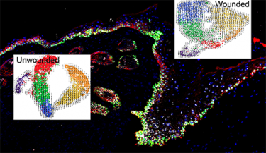 diagrams of cell heterogeneity both in unwounded and wounded skin cells