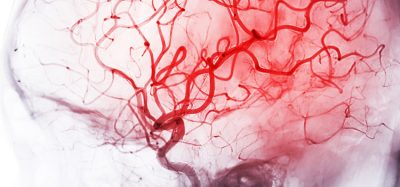 cerebrovascular disease