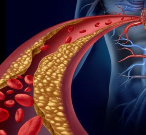 cholesterol