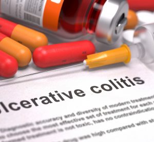 colitis
