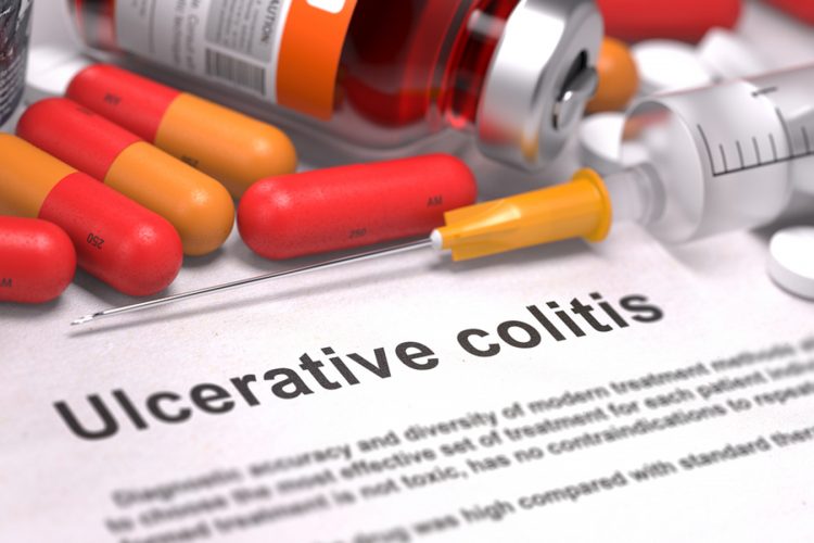 colitis