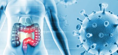 Colon cancer. Cancer attacking cells. 3d illustration