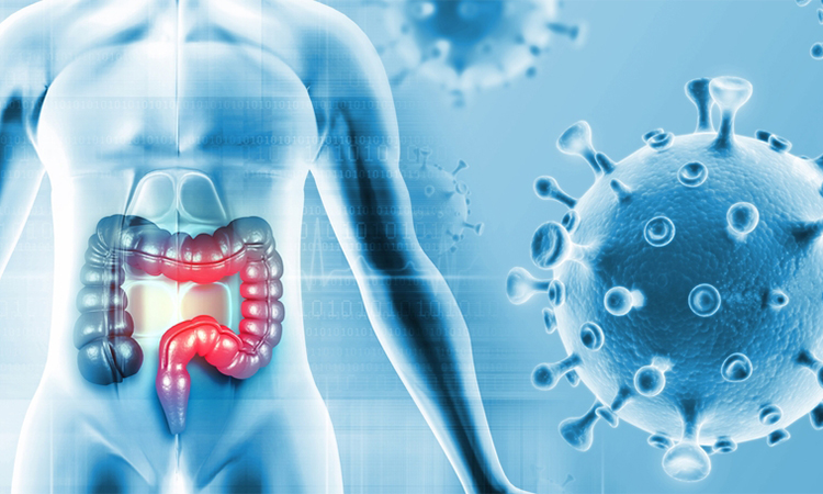 Colon cancer. Cancer attacking cells. 3d illustration