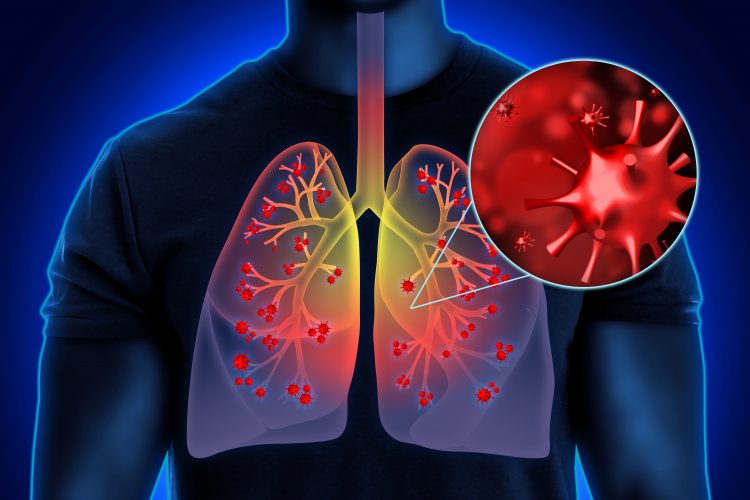 man with red coronavirus particles in his lungs