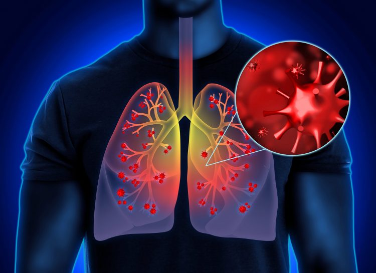 man with red coronavirus particles in his lungs