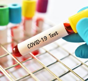 blood vial with 'COVID-19 test' written on it