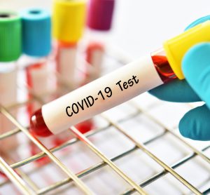 blood vial with 'COVID-19 test' written on it